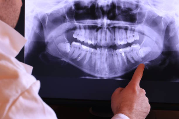 Best Emergency Treatment for Jaw Pain or Injury in Clinton, MS